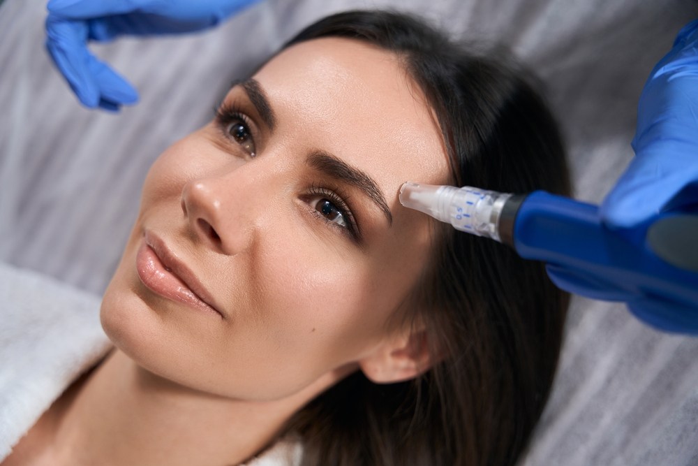 Skin texture before and after microneedling
