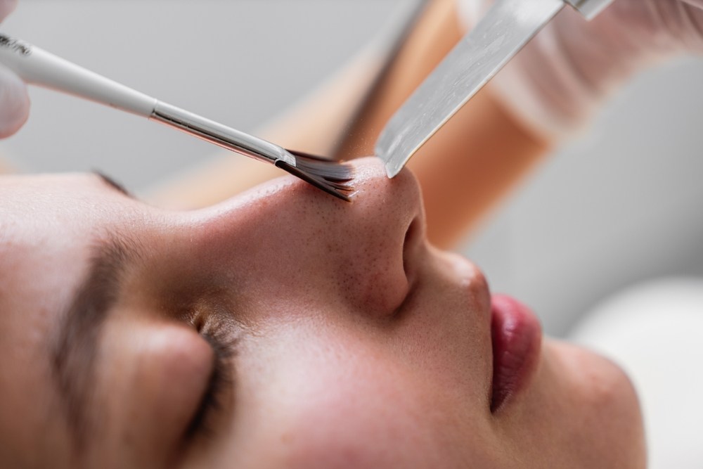 Skin clarity before and after dermaplaning