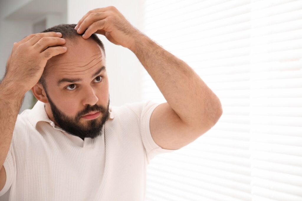 Scalp micropigmentation thinning hair density