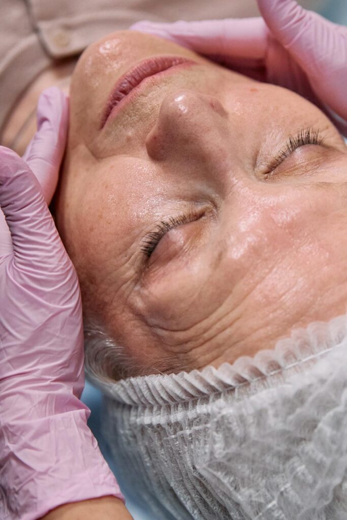 Mature client during a plasma fibroblast skin tightening treatment